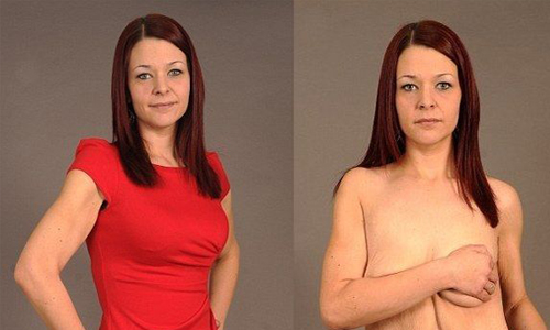 瘦身成功了、性生活沒了！胖妞激瘦60公斤反而不開心 減肥、肥胖、瘦身、結婚、婚姻