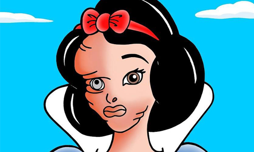 公主慘遭王子潑酸毀容　插畫警示驚悚社會現象 迪士尼、公主、潑酸、硫酸、倖存