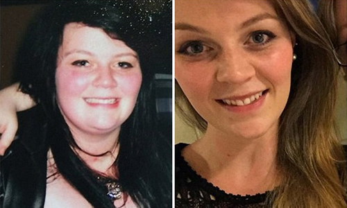 瘦身不是甩掉脂肪就結束了！美女快速減肥的代價竟是...... 快速減肥、皮膚鬆弛、切除手術、募款、私家整容