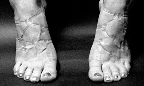 妳對自己的身體做了什麼？9張圖提醒你甩開束縛！ 身體、性感、美、 Justin Bartels、緊身、攝影、圖片、馬甲、涼鞋、美、緊身褲、Underwear、Legging、Skinny