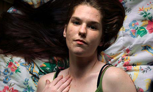 染毒癮只會變醜變老！嗑藥少女的戒毒紀實攝影 Stephanie、吸毒、毒品、Tony Fouhse、加拿大