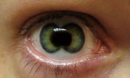 你敢直視嗎？令人狂起雞皮疙瘩的隱形眼鏡 隱形眼鏡、可怕、詭異、直視、嚇人