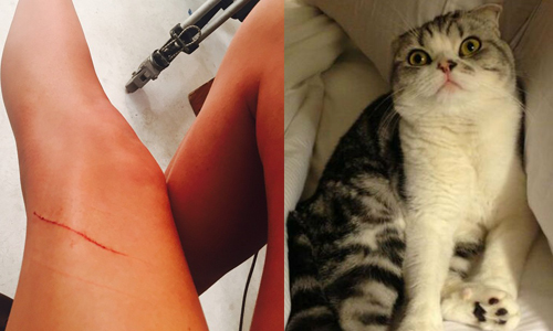 妞快報：小天后的腿你也敢刮？！泰勒絲稱愛貓一夕背債12億 妞快報、泰勒絲、貓、 Meredith、受傷