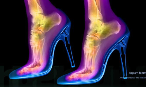 骷顱人穿高跟鞋也能很美！22張照片帶你一窺X光下的秘密 Hugh Turvey、X光、攝影、xogram、透視