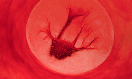 拋開穢物之名展現純粹美麗 經血藝術攝影 經血、藝術、攝影、Jen Lewis、Beauty in Blood、藝術