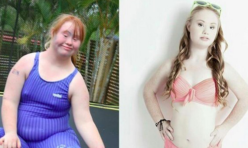別讓他人定義你自己！唐氏症女模企圖改變社會刻板印象 Madeline Stuart、唐氏症、模特兒、刻板印象、激勵