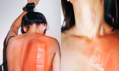 曬傷也可以很藝術？當懷舊底片烙印在人體上 Thomas Mailaender、曬傷、懷舊、底片、烙印