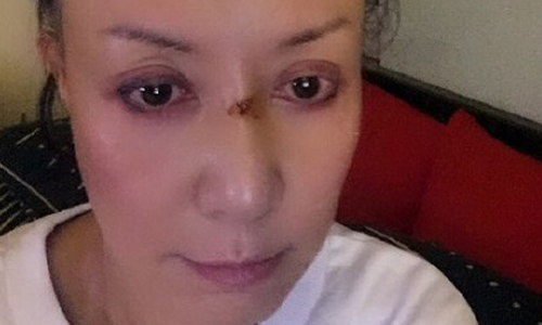 妞快報：羅霈穎分享「無鼻照」自嘲鬼來了 網友神回：「佛地魔」 妞快報、羅霈穎、鼻子、整形、自嘲