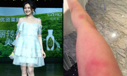 妞快報：「不是不當紙片人了嗎？」 大S為瘦手臂搞到自己變殭屍手？ 大S、懷孕、瘦身、紙片人、手臂