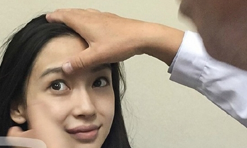 妞快報：Angelababy到底有沒有整型？眾所矚目的鑑定報告出爐！ Angelababy、黃曉明、整形、鑑定、結果