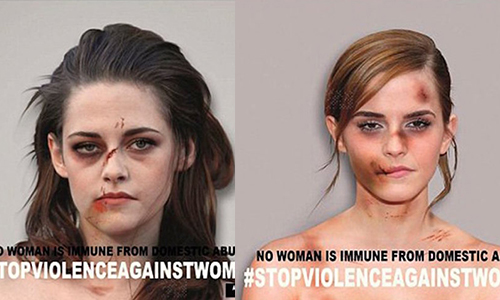 多位好萊塢女星慘遭家暴？！8張鼻青臉腫照片讓人看了心驚驚 國際終止婦女受暴日、家暴、受害、No Women is Immune from Domestic Violence、aleXsandro Palombo