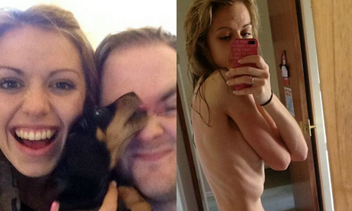 厭食症女子瘦到全身只剩排骨 男友讓她神奇康復的方法是....？ 厭食症、Emma Stokes、男友、求婚、Chris Weir