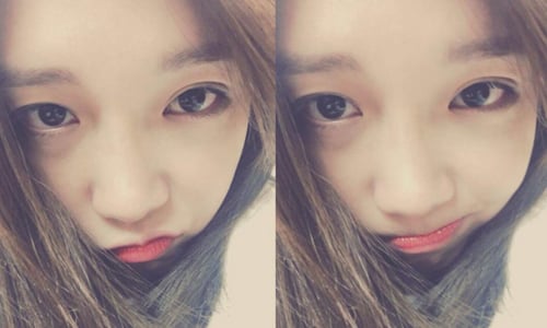 不想再因為痘痘而毀妝啦～4招教女孩跟惱人的嘴邊痘說再見 嘴邊痘、保養、預防、解決、暴飲暴食