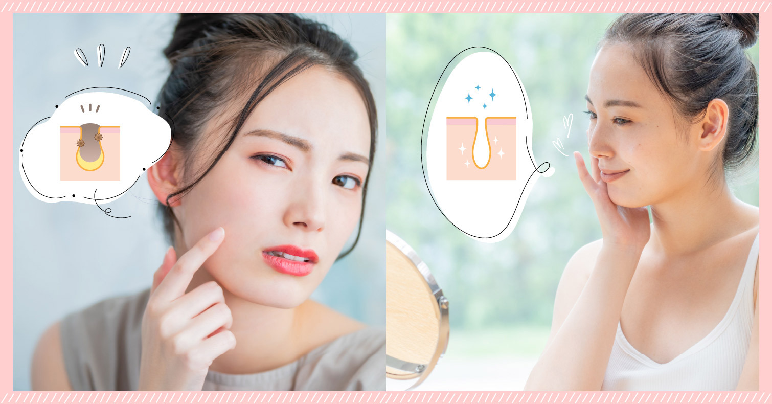 拯救你的粗大毛孔！推薦14款專家嚴選的毛孔護理精華液及排行榜（下） 増村Yukali、好物推薦、毛孔護理精華液、毛孔、精華液