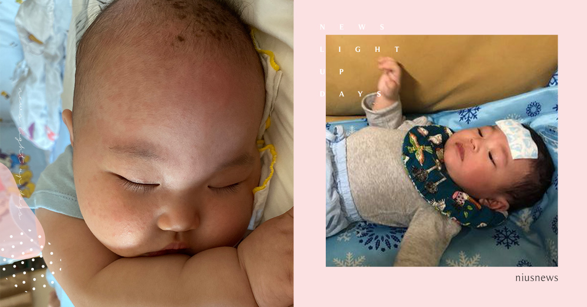 疫情期連續3天40度高燒還查不出病因？嬰幼兒常見「玫瑰疹」的明顯病徵及照護方式 媽媽妞、親子妞、高燒、發燒、玫瑰疹、嬰幼兒、2歲以下、就醫、新冠狀病毒、covid-19、觀察、阿包醫生、健康生活、育兒教養