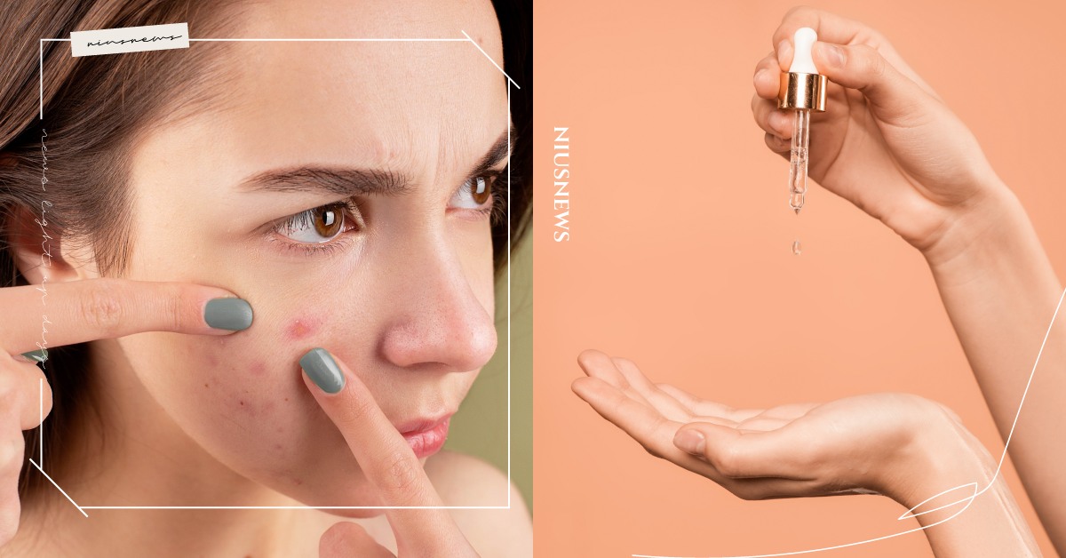 粉刺痘痘狂爆怎辦？皮膚科醫師傳授「3多3少」保養守則，酸類煥膚原來這樣挑更有感 粉刺、皮膚科醫師、防疫、口罩痘、理膚寶水、酸類煥膚、吳吉妮、DRWU、角質代謝異常