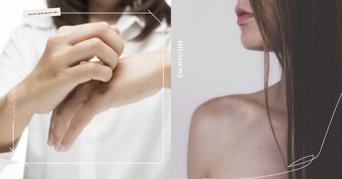 濕疹症狀有哪些？該如何治療？皮膚保濕、正常睡眠等日常5保養必知 健康、身體、皮膚、濕疹、異味性皮膚炎、保養、過敏原、飲食、壓力