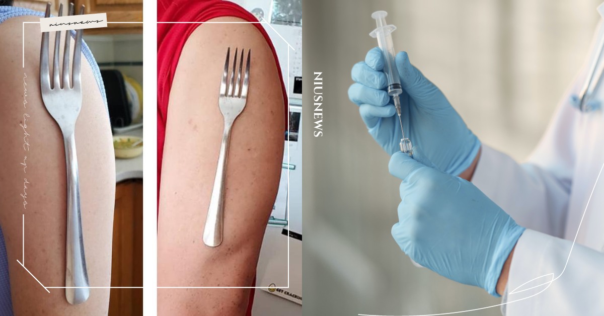 打疫苗後會變「萬磁王」？台大醫師回應真相驚呆網友，常見「新冠手臂」症狀一次了解 新冠肺炎、新冠手臂、疫苗、皮膚科、朱家瑜教授