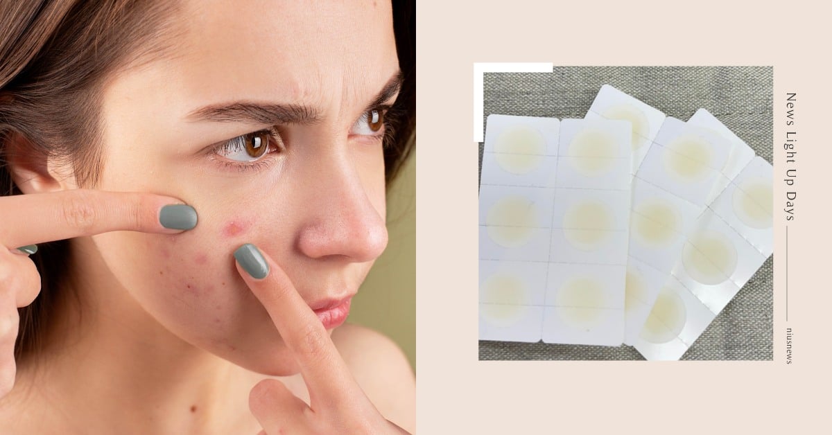 不是貼了就有用！皮膚科醫師提醒「痘痘貼」正確用法及時機，貼完出現這兩狀況快停用 痘痘貼、皮膚科醫師、唐豪悅