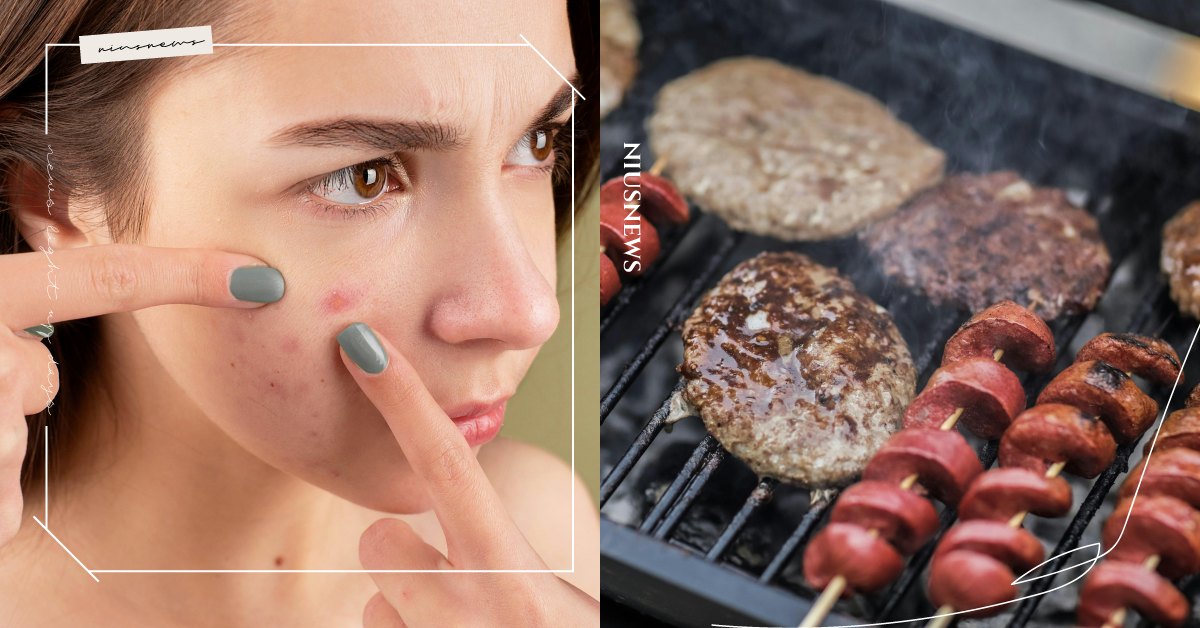 中秋烤肉後爆痘、搔癢起紅疹？皮膚科醫師點出關鍵1原因，預防烤肉皮膚變差5方法快學 皮膚科醫師、中秋節、痘痘、長痘、烤肉、吳明穎、爆痘、PAHs、環芳香烴