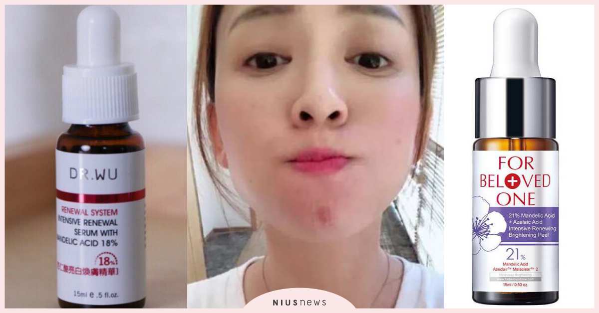 「居家煥膚」4大NG迷思你犯了嗎？皮膚科醫師提點正確觀念，痘痘、粉刺肌必看！ 居家煥膚、皮膚科醫師、杏仁酸、蔡依倫、痘痘