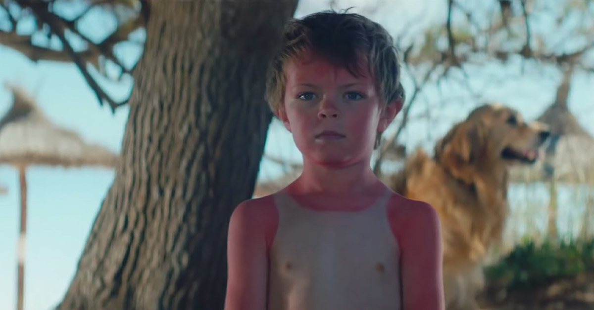 曬到紅通通的丹麥小孩 提醒你防曬的重要阿！ 紫外線、防曬乳、海邊