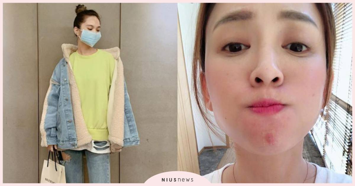 戴口罩防疫卻爆痘？皮膚科醫師邱品齊提點「3要1不要」對策，不想變花臉必看  皮膚科醫師、邱品齊、防疫、武漢肺炎、戴口罩