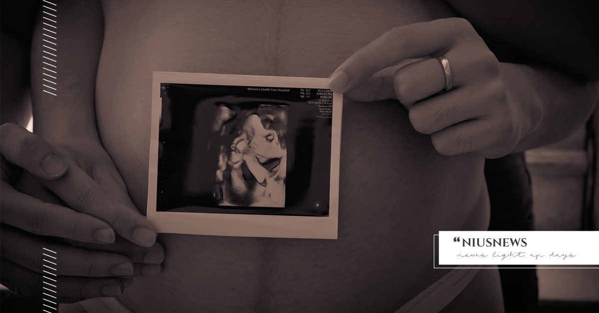 超音波照片絕對不能護貝！3個方式永久保存寶寶的超音波照片 親子妞、超音波照片、產檢、懷孕、超音波、黑白、影印、護貝、保存、紀念品、拍照