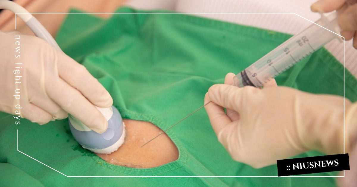 如何挑選自費產檢？妊娠糖尿病、染色體基因檢查有必要做嗎？ 懷孕、孕媽咪、產檢、超音波、羊膜穿刺